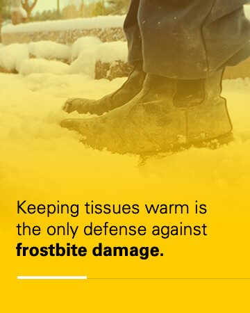 keeping tissues warm prevents frostbite